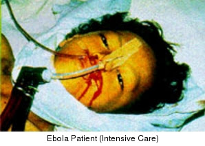 infectado de ébola....